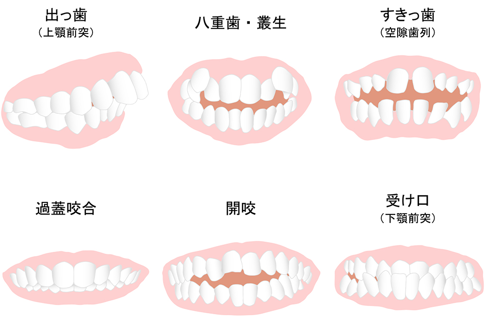 適応の幅の広さ